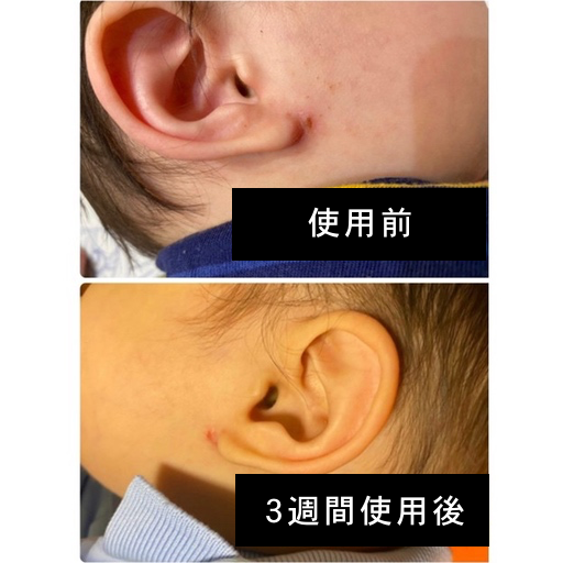 アズシエル_3